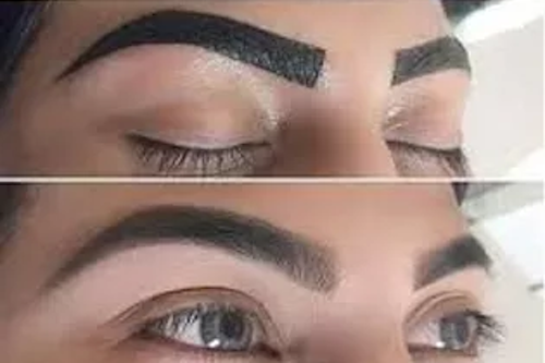 Brow Enhancements Image