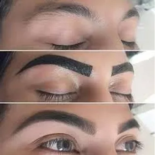 Brow Enhancements Image