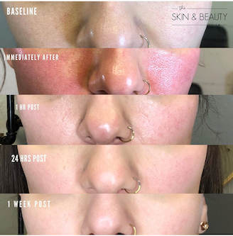 Skin Treatments Image